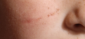 forsikringsfoto-2